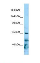 POLR2A / RNA polymerase II Antibody - Western blot of Human Hela. POLR2A antibody dilution 1.0 ug/ml.  This image was taken for the unconjugated form of this product. Other forms have not been tested.