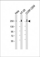 POLR2A / RNA polymerase II Antibody - All lanes: Anti-POLR2A Antibody (monoclonal) (M01AA) at 1:2000 dilution Lane 1: Hela whole cell lysate Lane 2: HT-29 whole cell lysate Lane 3: CCRF-CEM whole cell lysate Lysates/proteins at 20 µg per lane. Secondary Goat Anti-mouse IgG, (H+L), Peroxidase conjugated at 1/10000 dilution. Predicted band size: 217 kDa Blocking/Dilution buffer: 5% NFDM/TBST.