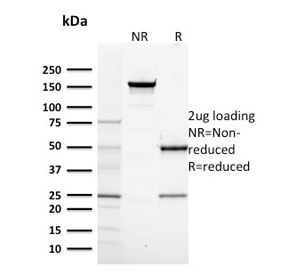 POLR2A / RNA polymerase II Antibody - SDS-PAGE analysis of purified, BSA-free POLR2A antibody (clone CTD4H8) as confirmation of integrity and purity.