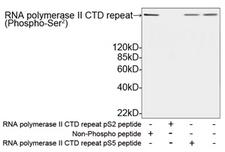 POLR2A / RNA polymerase II Antibody - Western blot analysis of MCF-7 cell lysates using RNA polymerase II CTD repeat Antibody (Phospho-Ser 2 ), pAb, Rabbit The signal was developed with IRDye TM 800 Conjugated Goat Anti-Rabbit IgG. Predicted Size: 217 kD Observed Size: 217 kD