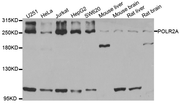 POLR2A / RNA polymerase II Antibody - Western blot analysis of extracts of various cell lines.