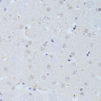 POLR2A / RNA polymerase II Antibody - Immunohistochemistry of paraffin-embedded mouse brain using POLR2A antibody at dilution of 1:100 (40x lens).