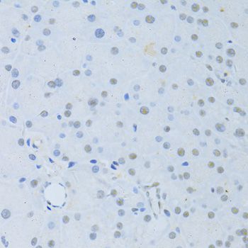 POLR2A / RNA polymerase II Antibody - Immunohistochemistry of paraffin-embedded mouse pancreas using POLR2A antibody at dilution of 1:100 (40x lens).