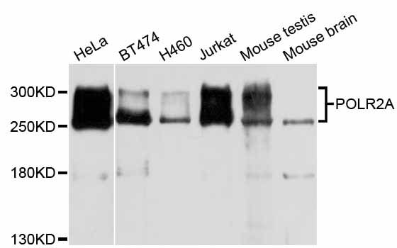 POLR2A / RNA polymerase II Antibody - Western blot analysis of extracts of various cell lines, using POLR2A antibody at 1:1000 dilution. The secondary antibody used was an HRP Goat Anti-Rabbit IgG (H+L) at 1:10000 dilution. Lysates were loaded 25ug per lane and 3% nonfat dry milk in TBST was used for blocking. An ECL Kit was used for detection and the exposure time was 30s.