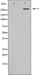POLR2A / RNA polymerase II Antibody - Western blot analysis of extracts of HeLa cells using POLR2A antibody. The lane on the left is treated with the antigen-specific peptide.