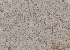 POLR2A / RNA polymerase II Antibody - 1:100 staining rat kidney tissue by IHC-P. The sample was formaldehyde fixed and a heat mediated antigen retrieval step in citrate buffer was performed. The sample was then blocked and incubated with the antibody for 1.5 hours at 22°C. An HRP conjugated goat anti-rabbit antibody was used as the secondary.