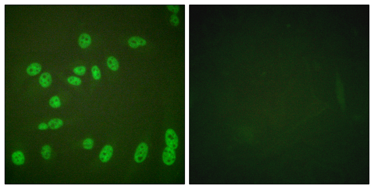 POLR2A / RNA polymerase II Antibody - Immunofluorescence analysis of HeLa cells treated with PMA 125ng/ml 30', using POLR2A (Phospho-Ser1619) Antibody. The picture on the right is blocked with the phospho peptide.