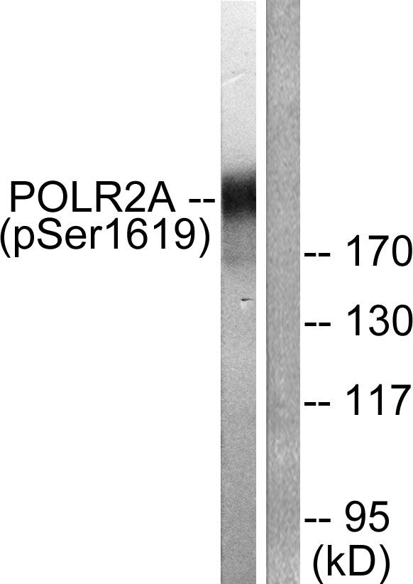 POLR2A / RNA polymerase II Antibody - Western blot analysis of lysates from COS7 cells treated with EGF 200ng/ml 30', using POLR2A (Phospho-Ser1619) Antibody. The lane on the right is blocked with the phospho peptide.