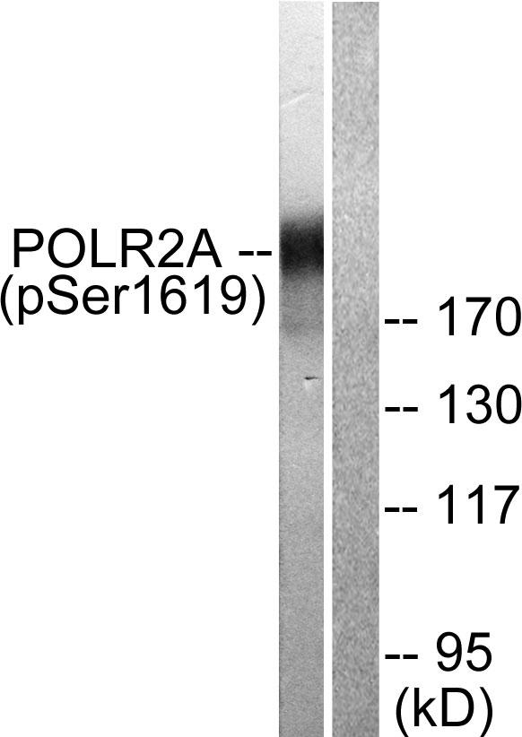 POLR2A / RNA polymerase II Antibody - Western blot analysis of extracts from COS7 cells treated with EGF (200ng/ml, 30mins), using POLR2A (phospho-Ser1619) antibody.
