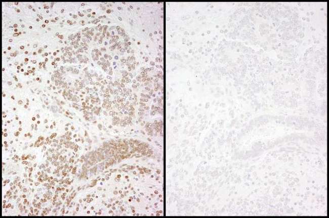 POLR2A / RNA polymerase II Antibody - Detection of Mouse Phospho-RNA Polymerase II (S2) by Immunohistochemistry. Samples: FFPE serial sections of mouse teratoma. Mock phosphatase treated section (left) or calf intestinal phosphatase-treated section (right) immunostained for Phospho-RNA Polymerase II (S2). Antibody: Affinity purified rabbit anti-Phospho-RNA Polymerase II (S2) used at a dilution of 1:250.