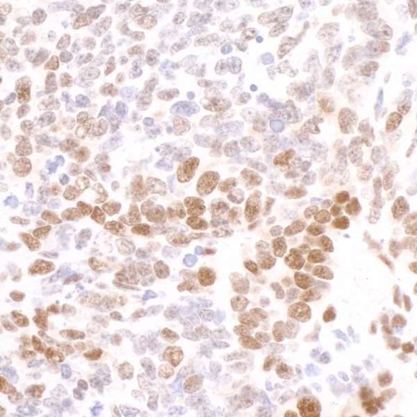 POLR2A / RNA polymerase II Antibody - Detection of mouse Phospho-RNA Polymerase II (S2) by immunohistochemistry. Sample: FFPE section of mouse teratoma. Antibody: Affinity purified rabbit anti-Phospho-RNA Polymerase II (S2) used at a dilution of 1:200 (1µg/ml). Detection: DAB