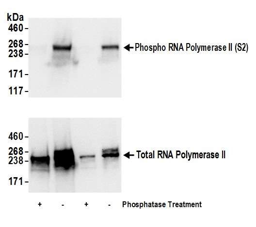 POLR2A / RNA polymerase II Antibody - Detection of human Phospho RNA Polymerase II (S2) by western blot. Samples: Whole cell lysate (50 and 15 µg) from HeLa prepared using NETN buffer. Lysate was mock treated (-) or treated with phosphatases (+). Antibodies: Affinity purified rabbit anti-Phospho RNA Polymerase II (S2) antibody was used for WB at 0.04 µg/ml (upper panel). To examine total RNA Polymerase II, rabbit anti-RNA Polymerase II antibody was used at 1 µg/ml (lower panel). Detection: Chemiluminescence with exposure time of 3 seconds.