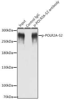 POLR2A / RNA polymerase II Antibody - Immunoprecipitation analysis of 200ug extracts of MCF-7 cells, using 3 ug Phospho-POLR2A-S2 pAb. Western blot was performed from the immunoprecipitate using Phospho-POLR2A-S2 pAb at a dilition of 1:1000. MCF7 cells were treated by nocodazole (50 ng/ml) at 37°C for 20 hours.