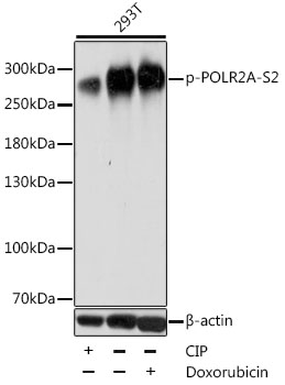 POLR2A / RNA polymerase II Antibody - Western blot analysis of extracts of 293T cells, using Phospho-POLR2A-S2 antibody at 1:1000 dilution. 293T cell lysate were treated by CIP (20ul CIP for each 400ul cell lysate) at 37â„ƒ for 1 hour or treated by Doxorubicin (0.5uM) for 24 hours. The secondary antibody used was an HRP Goat Anti-Rabbit IgG (H+L) at 1:10000 dilution. Lysates were loaded 25ug per lane and 3% nonfat dry milk in TBST was used for blocking. Blocking buffer: 3% BSA.An ECL Kit was used for detection and the exposure time was 1s.