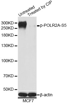 POLR2A / RNA polymerase II Antibody - Western blot analysis of extracts of MCF7 cells, using Phospho-POLR2A-S5 antibody at 1:1000 dilution. MCF7 cell lysate were treated by CIP (20ul CIP for each 400ul cell lysate) at 37â„ƒ for 1 hour. The secondary antibody used was an HRP Goat Anti-Rabbit IgG (H+L) at 1:10000 dilution. Lysates were loaded 25ug per lane and 3% nonfat dry milk in TBST was used for blocking. Blocking buffer: 3% BSA.An ECL Kit was used for detection and the exposure time was 1s.