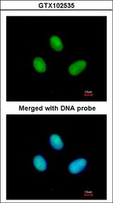 POLR2B / RPB2 Antibody - Immunofluorescence of paraformaldehyde-fixed HeLa using POLR2B antibody at 1:200 dilution.