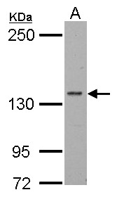POLR2B / RPB2 Antibody - Sample (30 ug of whole cell lysate). A: BCL-1. 5% SDS PAGE. POLR2B / RPB2 antibody diluted at 1:1000.