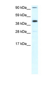 POLR2B / RPB2 Antibody - POLR2B / RPB2 antibody Western blot of Fetal Muscle lysate. This image was taken for the unconjugated form of this product. Other forms have not been tested.
