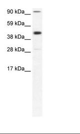 POLR2B / RPB2 Antibody - Fetal Muscle Lysate.  This image was taken for the unconjugated form of this product. Other forms have not been tested.