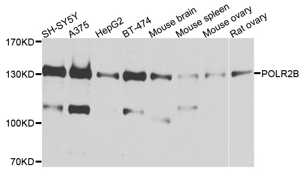 POLR2B / RPB2 Antibody - Western blot analysis of extracts of various cells.