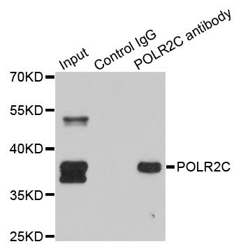 POLR2C Antibody - Immunoprecipitation analysis of 150ug extracts of SW620 cells using 3ug POLR2C antibody. Western blot was performed from the immunoprecipitate using POLR2C antibodyat a dilition of 1:500.