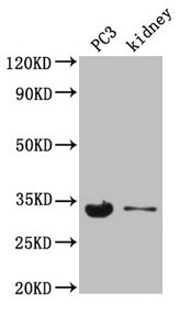 POLR2C Antibody - Western Blot Positive WB detected in: Hela whole cell lysate, HEK293 whole cell lysate, HepG2 whole cell lysate, PC-3 whole cell lysate, SH-SY5Y whole cell lysate, A549 whole cell lysate, Mouse kidney tissue All lanes: POLR2C antibody at 3.5µg/ml Secondary Goat polyclonal to rabbit IgG at 1/50000 dilution Predicted band size: 32 kDa Observed band size: 32 kDa