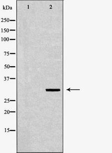 POLR2C Antibody - Western blot analysis of HeLa whole cell lysates using POLR2C antibody. The lane on the left is treated with the antigen-specific peptide.