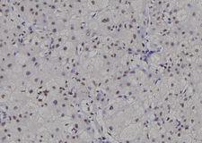 POLR2C Antibody - 1:100 staining human liver tissue by IHC-P. The sample was formaldehyde fixed and a heat mediated antigen retrieval step in citrate buffer was performed. The sample was then blocked and incubated with the antibody for 1.5 hours at 22°C. An HRP conjugated goat anti-rabbit antibody was used as the secondary.