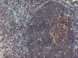 POLR2E Antibody - IHC of paraffin-embedded Human tonsil using anti-POLR2E mouse monoclonal antibody. (Heat-induced epitope retrieval by 10mM citric buffer, pH6.0, 100C for 10min).