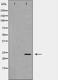 POLR2E Antibody - Western blot analysis of MCF-7 cell lysates using POLR2E antibody. The lane on the left is treated with the antigen-specific peptide.