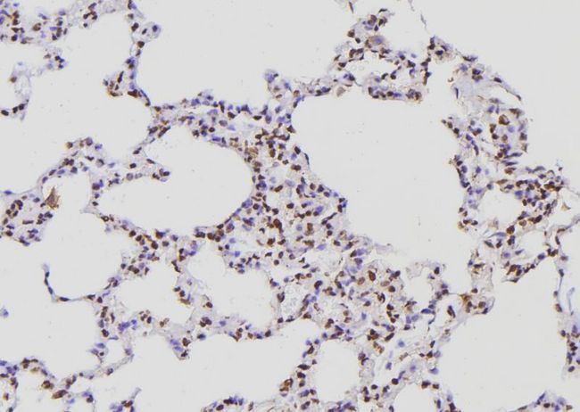 POLR2E Antibody - 1:100 staining rat lung tissue by IHC-P. The sample was formaldehyde fixed and a heat mediated antigen retrieval step in citrate buffer was performed. The sample was then blocked and incubated with the antibody for 1.5 hours at 22°C. An HRP conjugated goat anti-rabbit antibody was used as the secondary.