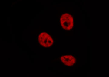 POLR2E Antibody - Staining MCF-7 cells by IF/ICC. The samples were fixed with PFA and permeabilized in 0.1% Triton X-100, then blocked in 10% serum for 45 min at 25°C. The primary antibody was diluted at 1:200 and incubated with the sample for 1 hour at 37°C. An Alexa Fluor 594 conjugated goat anti-rabbit IgG (H+L) antibody, diluted at 1/600, was used as secondary antibody.