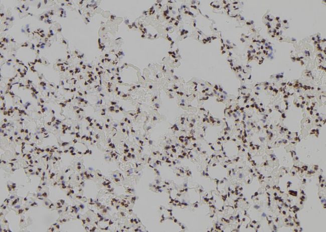 POLR2F Antibody - 1:100 staining rat lung tissue by IHC-P. The sample was formaldehyde fixed and a heat mediated antigen retrieval step in citrate buffer was performed. The sample was then blocked and incubated with the antibody for 1.5 hours at 22°C. An HRP conjugated goat anti-rabbit antibody was used as the secondary.
