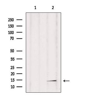 POLR2F Antibody - Western blot analysis of extracts of mouse brain tissue using RPAB2 antibody. Lane 1 was treated with the blocking peptide.
