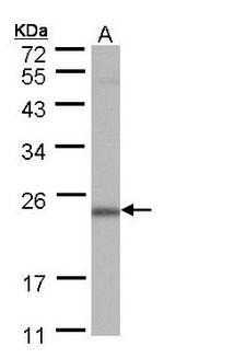 POLR2G / RPB7 Antibody - Sample (30 ug of whole cell lysate). A: A431. 12% SDS PAGE. POLR2G / RPB7 antibody diluted at 1:1000