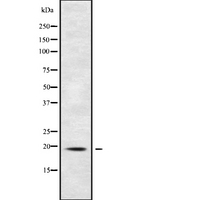 POLR2G / RPB7 Antibody - Western blot analysis of RPB7 using HuvEc whole cells lysates