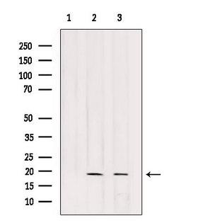 POLR2G / RPB7 Antibody - Western blot analysis of extracts of various samples using RPB7 antibody. Lane 1: HeLa treated with blocking peptide. Lane 2: HeLa; Lane 3: HepG2;