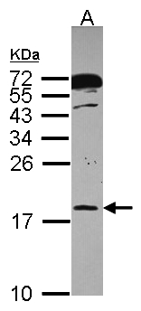 POLR2H / RPB8 Antibody - Sample (30 ug of whole cell lysate). A: A431 . 12% SDS PAGE. POLR2H antibody diluted at 1:1000.