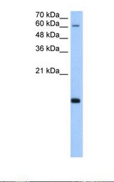 POLR2H / RPB8 Antibody - HepG2 cell lysate. Antibody concentration: 5.0 ug/ml. Gel concentration: 15%.  This image was taken for the unconjugated form of this product. Other forms have not been tested.