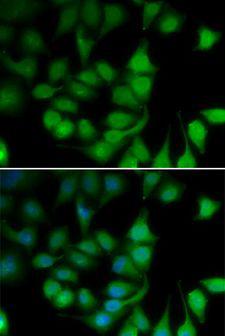 POLR2H / RPB8 Antibody - Immunofluorescence analysis of U2OS cells using POLR2H antibody. Blue: DAPI for nuclear staining.