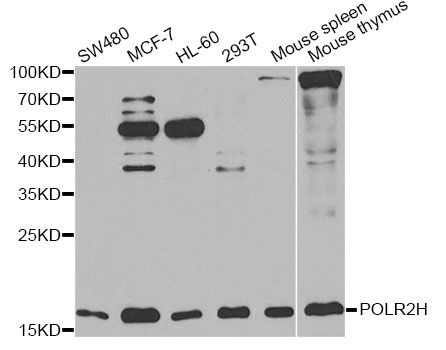 POLR2H / RPB8 Antibody - Western blot analysis of extracts of various cell lines, using POLR2H antibody at 1:1000 dilution. The secondary antibody used was an HRP Goat Anti-Rabbit IgG (H+L) at 1:10000 dilution. Lysates were loaded 25ug per lane and 3% nonfat dry milk in TBST was used for blocking. An ECL Kit was used for detection and the exposure time was 30s.