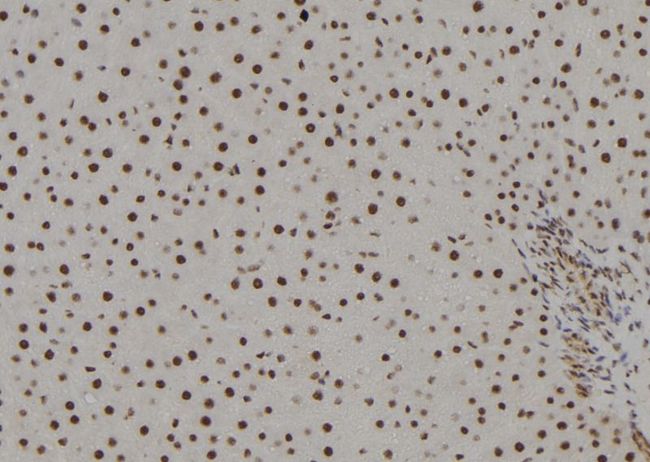 POLR2H / RPB8 Antibody - 1:100 staining rat liver tissue by IHC-P. The sample was formaldehyde fixed and a heat mediated antigen retrieval step in citrate buffer was performed. The sample was then blocked and incubated with the antibody for 1.5 hours at 22°C. An HRP conjugated goat anti-rabbit antibody was used as the secondary.