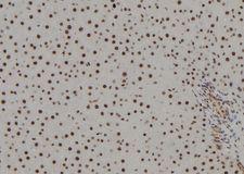 POLR2H / RPB8 Antibody - 1:100 staining rat liver tissue by IHC-P. The sample was formaldehyde fixed and a heat mediated antigen retrieval step in citrate buffer was performed. The sample was then blocked and incubated with the antibody for 1.5 hours at 22°C. An HRP conjugated goat anti-rabbit antibody was used as the secondary.