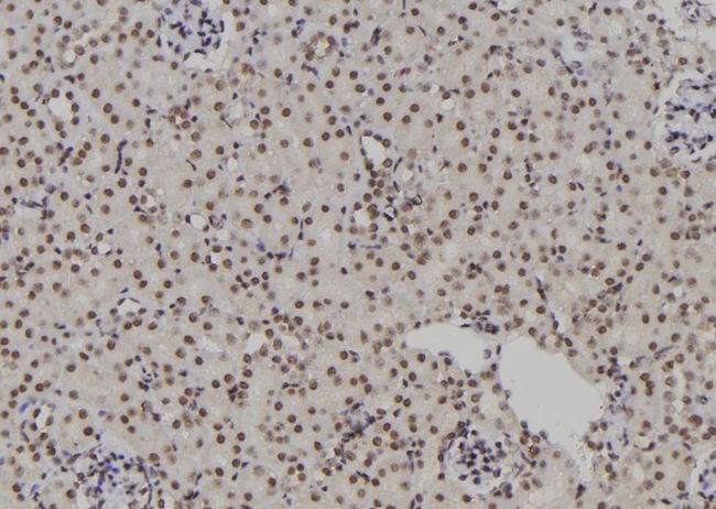 POLR2I Antibody - 1:100 staining rat kidney tissue by IHC-P. The sample was formaldehyde fixed and a heat mediated antigen retrieval step in citrate buffer was performed. The sample was then blocked and incubated with the antibody for 1.5 hours at 22°C. An HRP conjugated goat anti-rabbit antibody was used as the secondary.