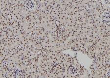 POLR2I Antibody - 1:100 staining rat kidney tissue by IHC-P. The sample was formaldehyde fixed and a heat mediated antigen retrieval step in citrate buffer was performed. The sample was then blocked and incubated with the antibody for 1.5 hours at 22°C. An HRP conjugated goat anti-rabbit antibody was used as the secondary.