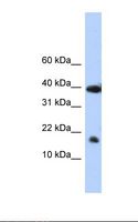 POLR2I Antibody - Placenta lysate. Antibody concentration: 1.0 ug/ml. Gel concentration: 10%-20%.  This image was taken for the unconjugated form of this product. Other forms have not been tested.