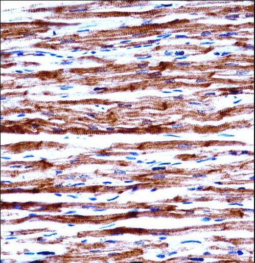 POLR2J Antibody - POLR2J Antibody immunohistochemistry of formalin-fixed and paraffin-embedded human heart tissue followed by peroxidase-conjugated secondary antibody and DAB staining.