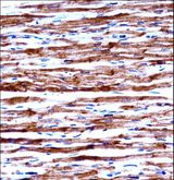 POLR2J Antibody - POLR2J Antibody immunohistochemistry of formalin-fixed and paraffin-embedded human heart tissue followed by peroxidase-conjugated secondary antibody and DAB staining.