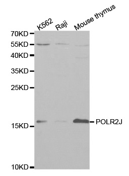 POLR2J Antibody - Western blot analysis of extracts of various cell lines.