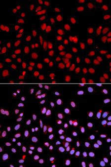POLR2J Antibody - Immunofluorescence analysis of U2OS cells.